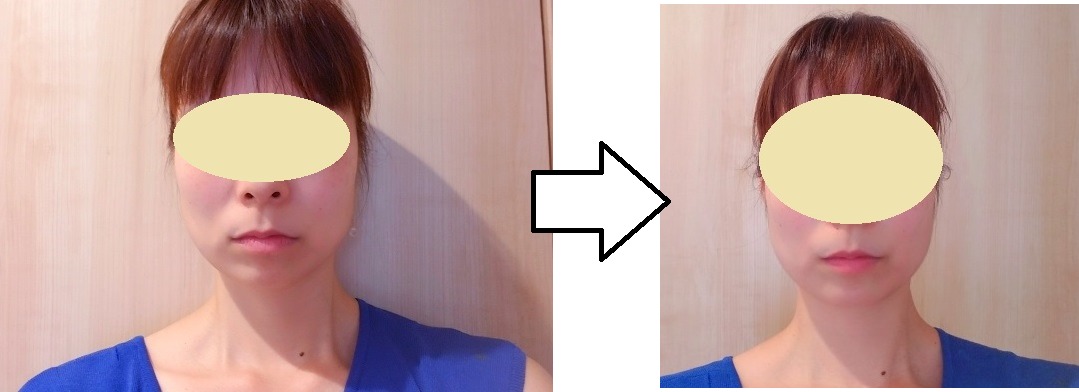 【体験談】ightフェイスブラは本当に効果があるの？口コミも調査！
