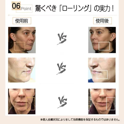 ジニューマーク美顔ローラーの口コミ評判と使い方!ほうれい線やあごのたるみで実際に検証!
