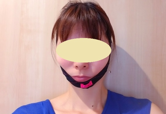 【体験談】ightフェイスブラは本当に効果があるの？口コミも調査！